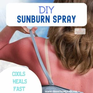 How to make homemade sunburn spray with peppermint, frankincense, lavender doterra essential oil and aloe vera juice