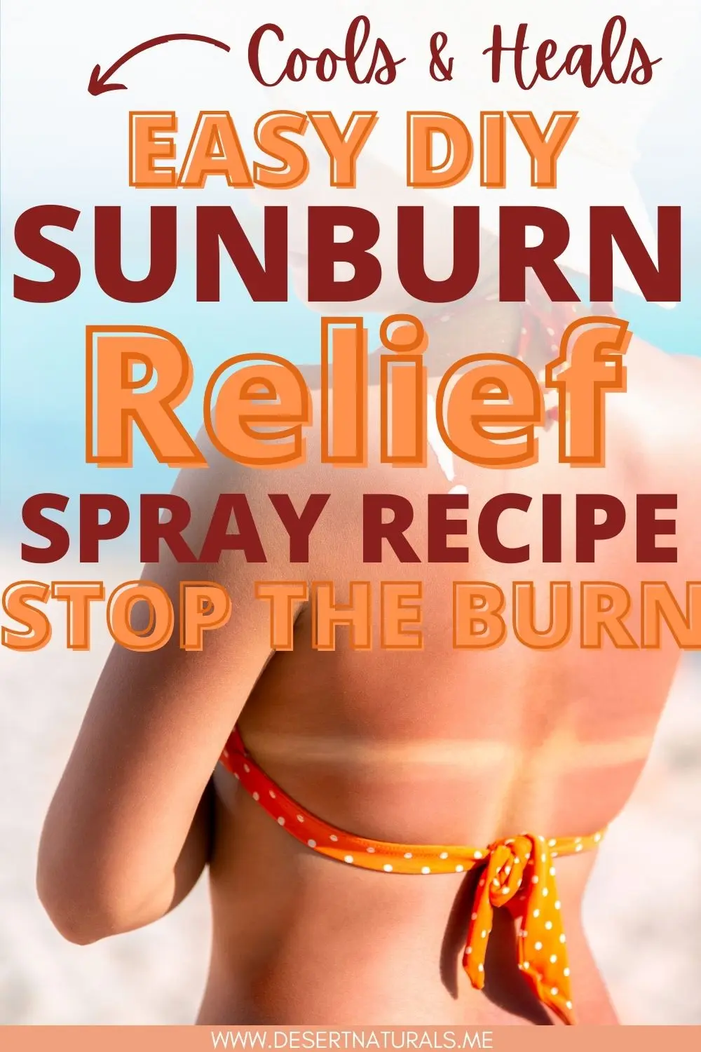 sunburn relief spray recipe pin with woman's sunburned back