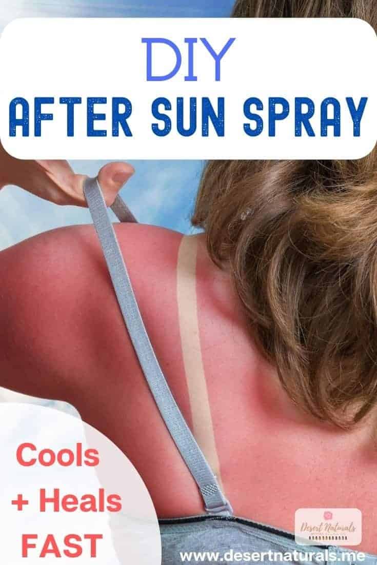Homemade sunburn spray to cool, soothe, and heal skin with aloe vera and doterra essential oils like Frankincense, Lavender, and Peppermint