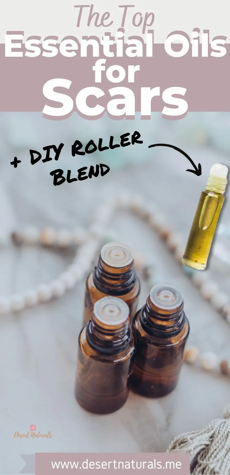 photo of essential oil bottles plus a roller and text top essential oils for scars