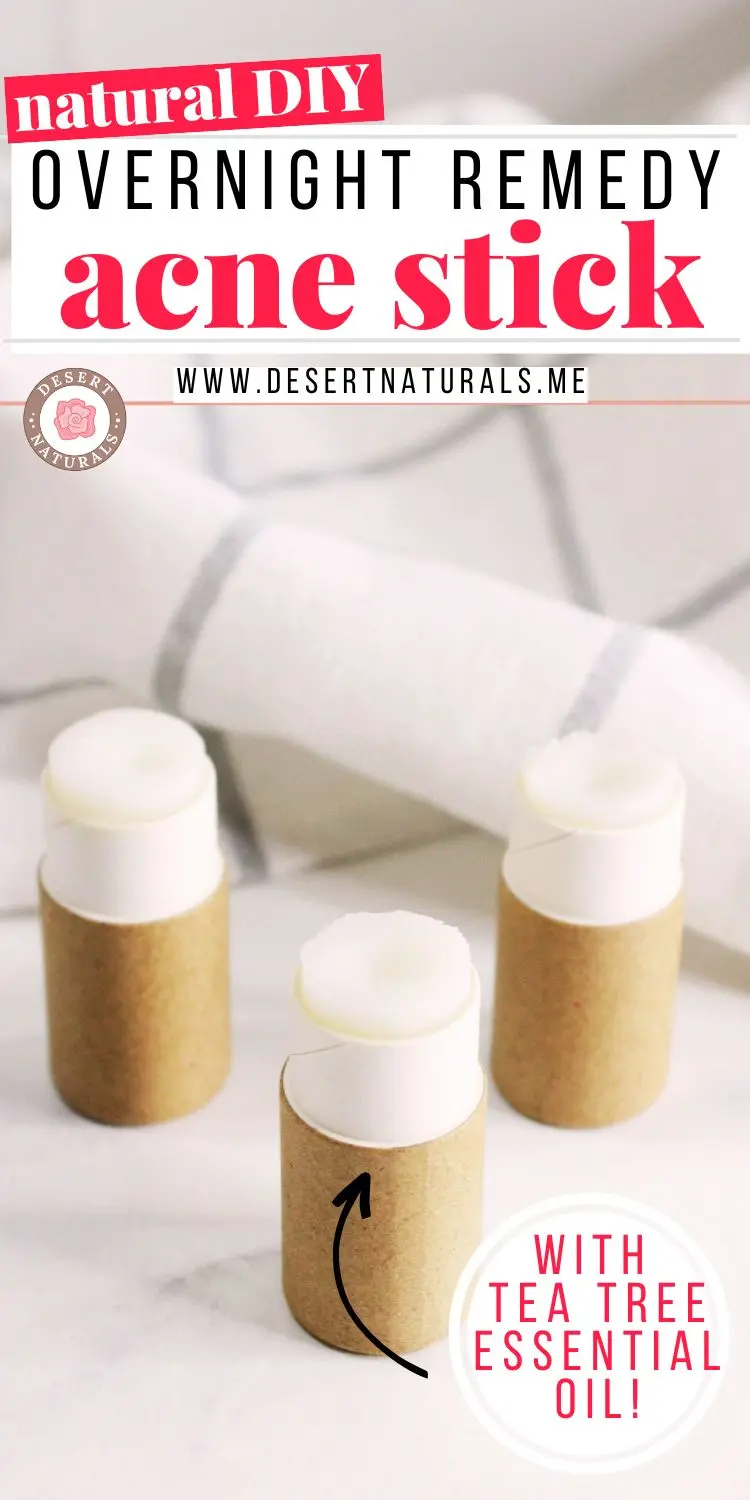 tubes of homemade pimple sticks for a natural homemade overnight acne remedy